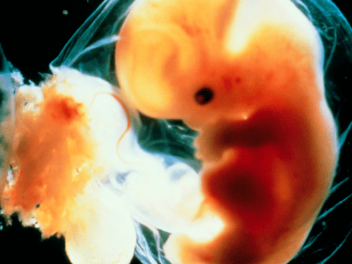 Human embryo 5-6 weeks after fertilisation
