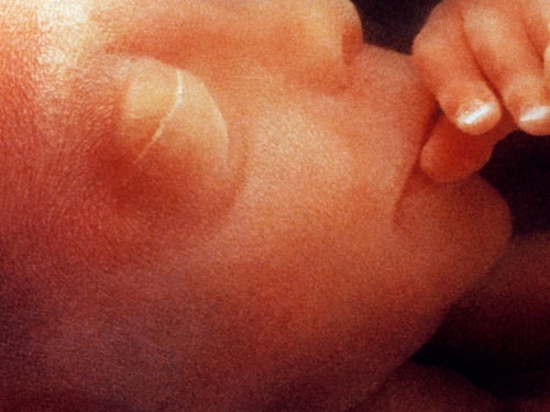 Foetus face aged 12 weeks