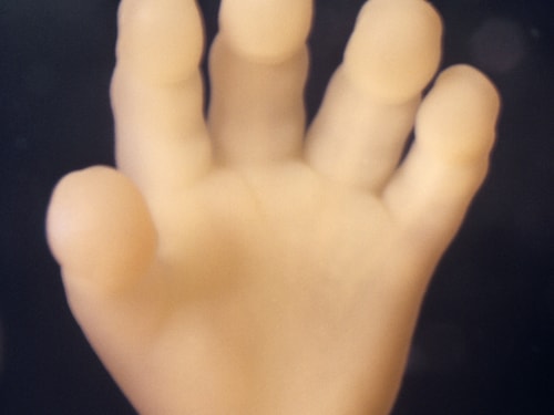 Foetal Hand 12 weeks